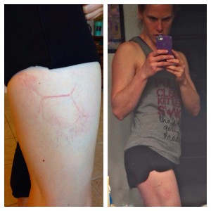 I'm pretty proud of this one. Soccer ball imprint on my leg hung around for almost a month!
